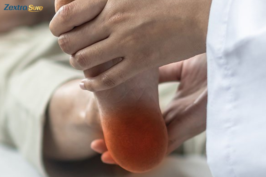 Gout in heel is a type of arthritis that occurs when uric acid builds up in the blood